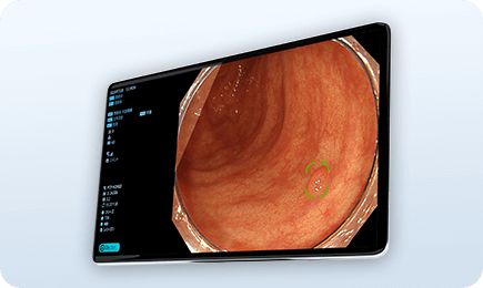 内視鏡支援AI搭載 最新の内視鏡システム オリンパスEVIS X1を挿入