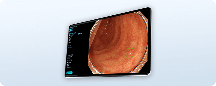 内視鏡支援AI搭載 最新の内視鏡システム オリンパスEVIS X1を挿入